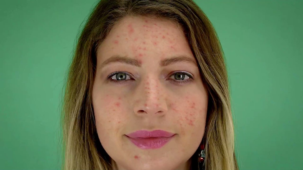Skin Positivity: Was versteht man unter dieser Bewegung?