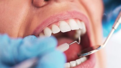 Aphten: Aus diesem Grund bekommen viele von uns die schmerzhaften Bläschen im Mund