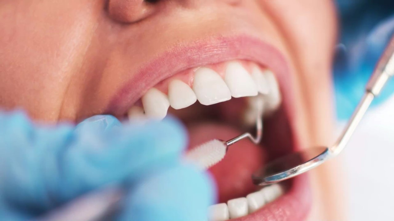 Aphten: Aus diesem Grund bekommen viele von uns die schmerzhaften Bläschen im Mund