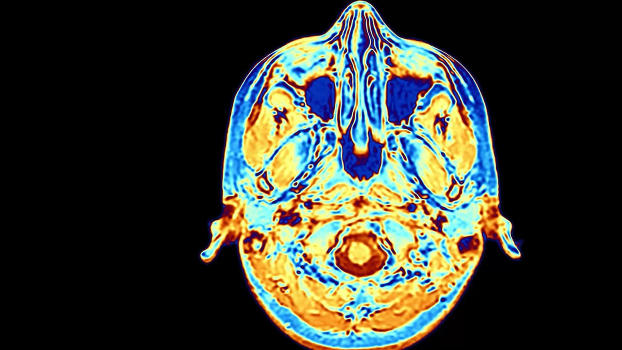 Corona: Gehirne von Säuglingen von Pandemie beeinträchtigt
