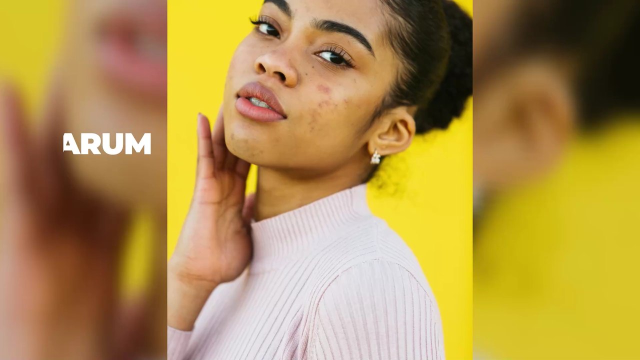 Akne: Diese Algen könnten das Heilmittel gegen Akne sein