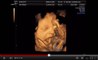 Les foetus bâillent dans le ventre de leur mère, la preuve en vidéo
