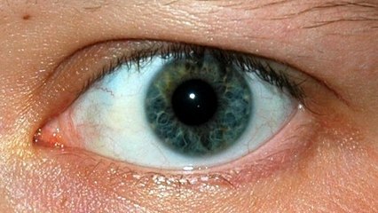 Pourquoi les paupières se mettent-elle parfois à trembler ?