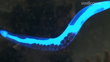 Des chercheurs observent la mort se propager dans le corps d'un ver