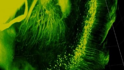 Comment mieux étudier un cerveau ? En le rendant transparent