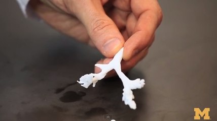 Imprimante 3D : quand sa technologie sauve un bébé de deux mois