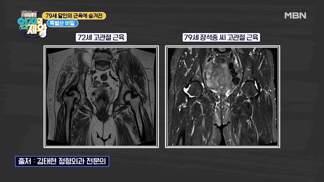 아픈 곳 하나 없는 달인! 그럴 수밖에 없던 이유가 있었다!?