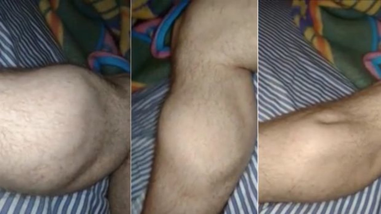 Ein heftiger Krampf wegen zu viel Sport