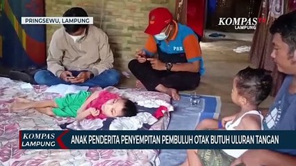 Anak Penderita Penyempitan Pembuluh Otak Butuhkan Uluran Tangan