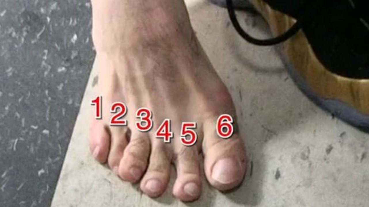 Danny Garcia ist mit seinen 6 Zehen unbesiegbar