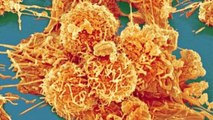Cancer : 65% des cas seraient liés à de la ''malchance'', selon une étude