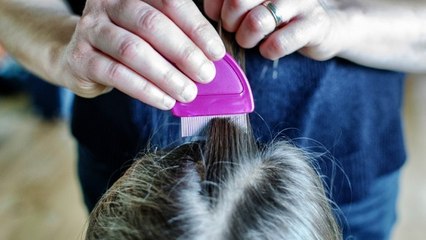 Poux : comment les reconnaitre et comment s'en débarrasser ?