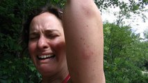 Pourquoi les moustiques attaquent certaines personnes plus que d'autres