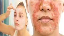 Face पर ये 1 चीज लगाना खतरनाक, Pimple से लेकर Wrinkles तक का खतरा | Boldsky