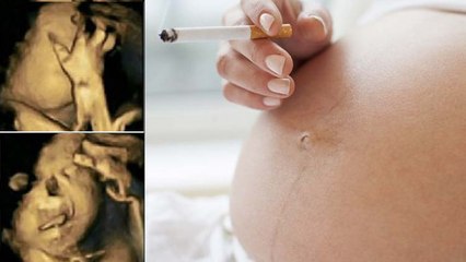 Les méfaits du tabagisme sur les foetus dévoilés grâce à des échographies ?