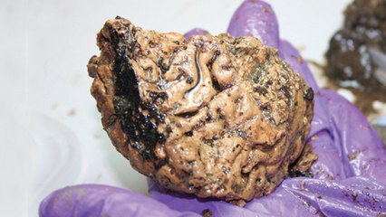 Les scientifiques percent les secrets d'un cerveau humain resté préservé pendant 2600 ans