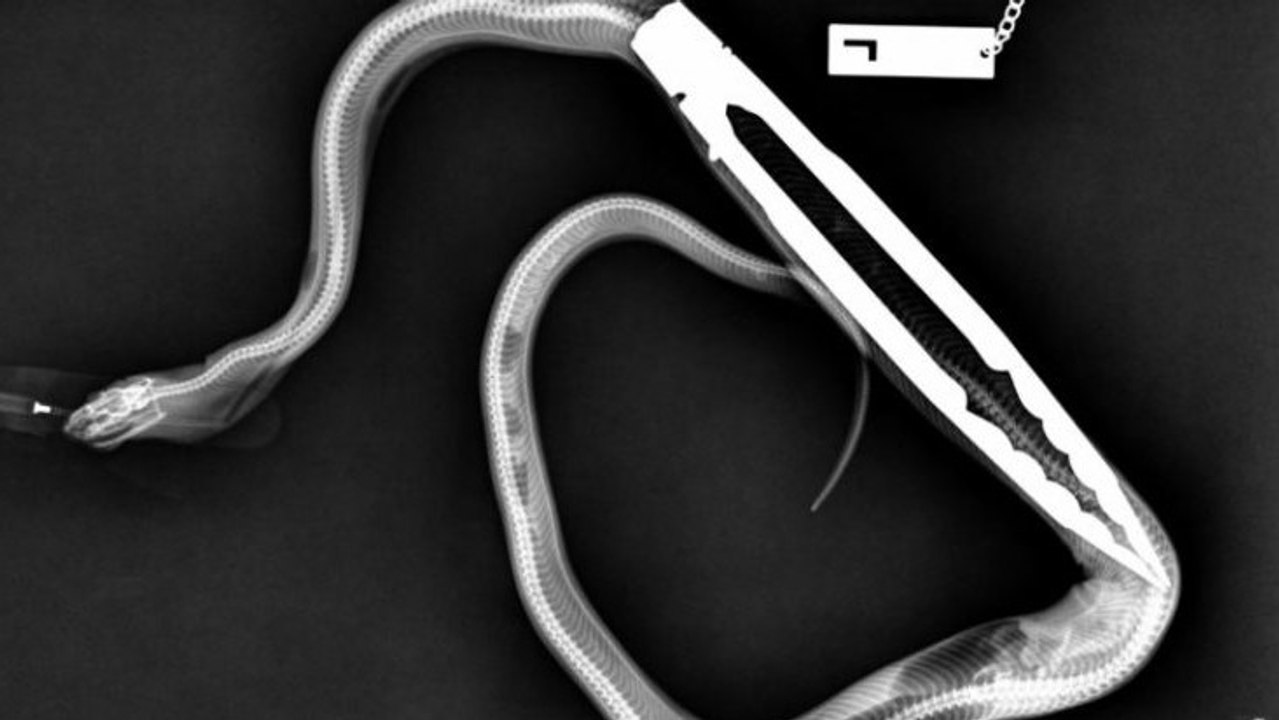 Le fantastique sauvetage d'un python qui avait avalé des pinces à barbecue
