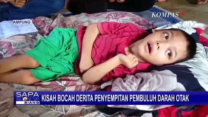 Mengidap Penyempitan Pembuluh Darah, Bocah Ini Hanya Bisa Terbaring di Tempat Tidur