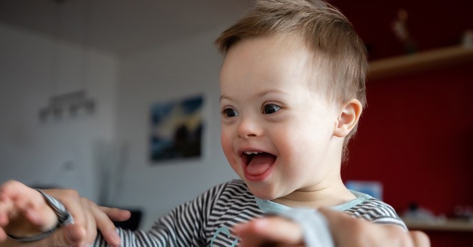 Trisomie 21 ou syndrome de Down : symptômes, causes, définition, de quoi s'agit-il ?