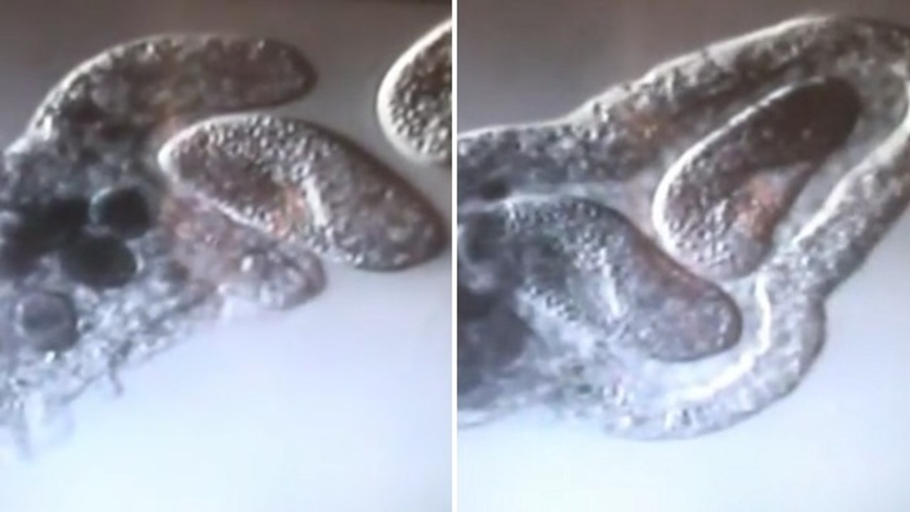 Observez l'étonnant repas d'une amibe qui engloutit deux paramécies