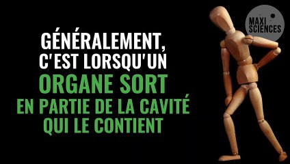 Hernie discale : symptômes, traitement, opération, comment la soigner ?