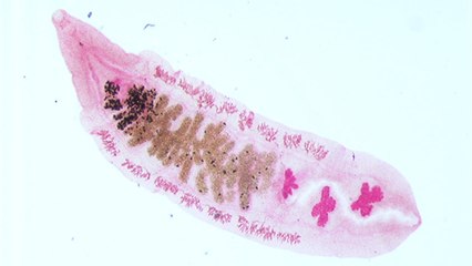 Ce ver parasite pourrait nous aider à cicatriser plus rapidement