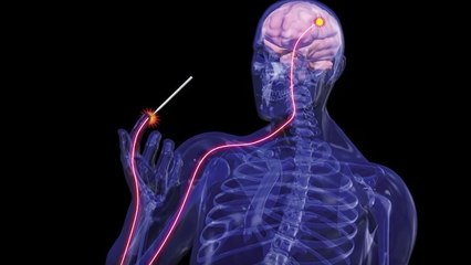 Une femme parvient à ressentir la douleur pour la première fois de sa vie