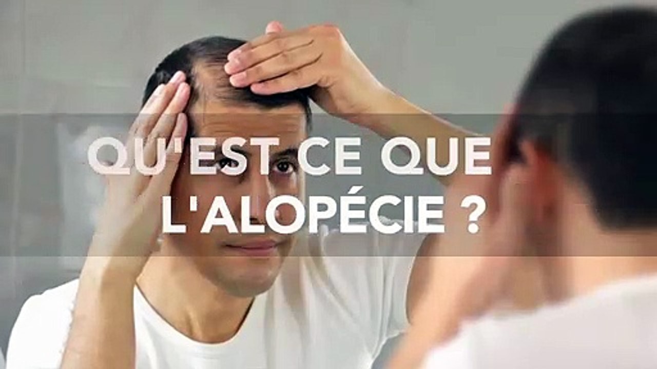 Alopécie (perte de cheveux) : définition, traitement, causes