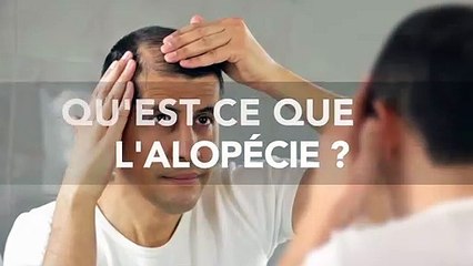 Alopécie (perte de cheveux) : définition, traitement, causes