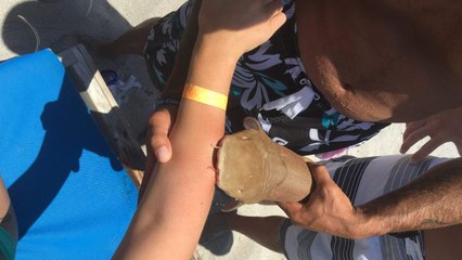 Mordue par un requin, elle va à l’hôpital avec l’animal accroché au bras