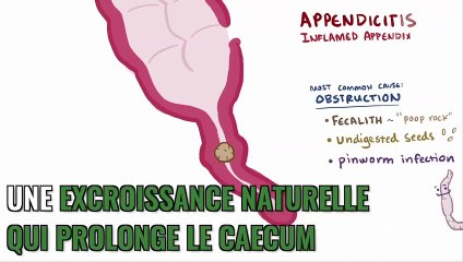 Appendice : définition, côté, rôle, douleur, de quoi s'agit-il ?
