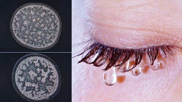 Voilà à quoi ressemblent des larmes sous un microscope