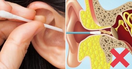 Comment faut-il faire pour bien se nettoyer les oreilles ?