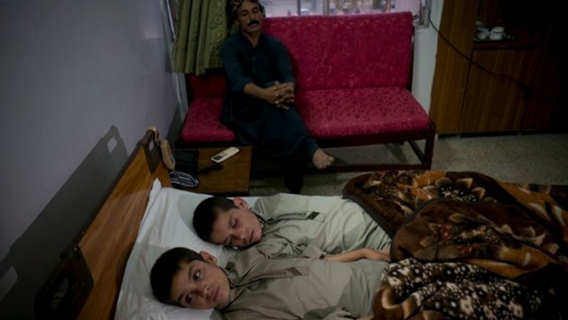 Ces deux enfants souffrent de paralysie lorsque le soleil se couche