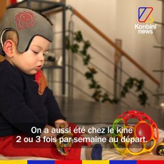 Le petit Maxence est né avec la tête plate, voici son quotidien l Reportage