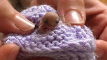 Voici le plus petit patient jamais soigné par des vétérinaires australiens