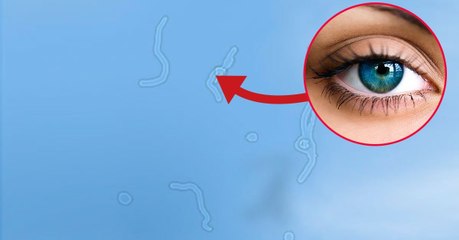 Que sont ces petits filaments lumineux qui flottent dans notre champ de vision ?