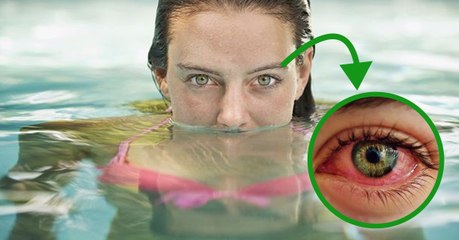 Pourquoi a-t-on les yeux rouges à la piscine ?