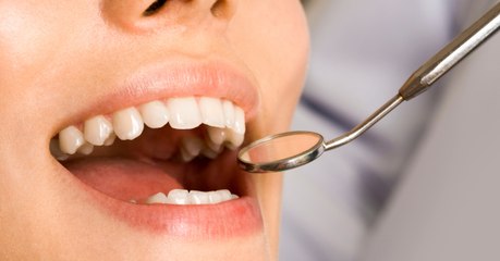 Carie : un traitement contre Alzheimer pourrait aider les dents à se régénérer