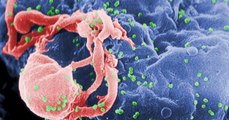 SIDA : des chercheurs découvrent un moyen d'identifier les 