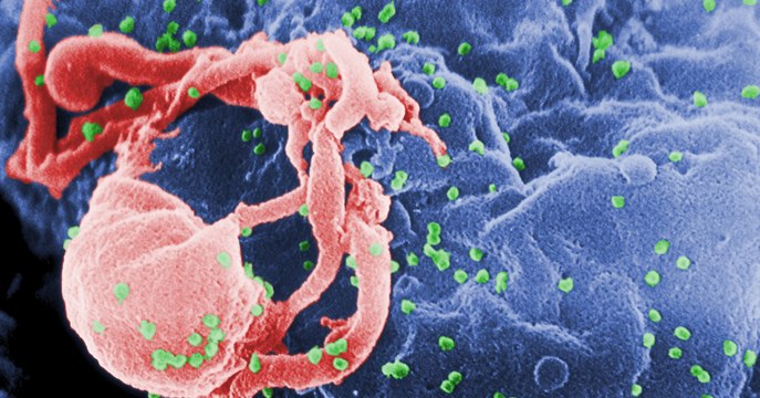 SIDA : des chercheurs découvrent un moyen d'identifier les cellules réservoirs qui cachent le VIH
