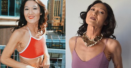 Sara Geurts, cette Américaine de 26 ans qui souffre d'une maladie qui la fait paraitre bien plus vieille