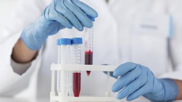 Protéine C réactive : définition, rôle, comment analyser les résultats ?