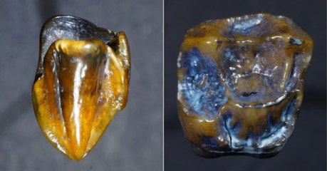 Ces dents vieilles de 9,7 millions d'années pourraient-elle réécrire l'histoire de l'humanité ?