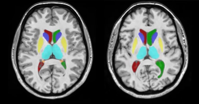Des chercheurs dévoilent comment notre cerveau évolue au cours de notre vie