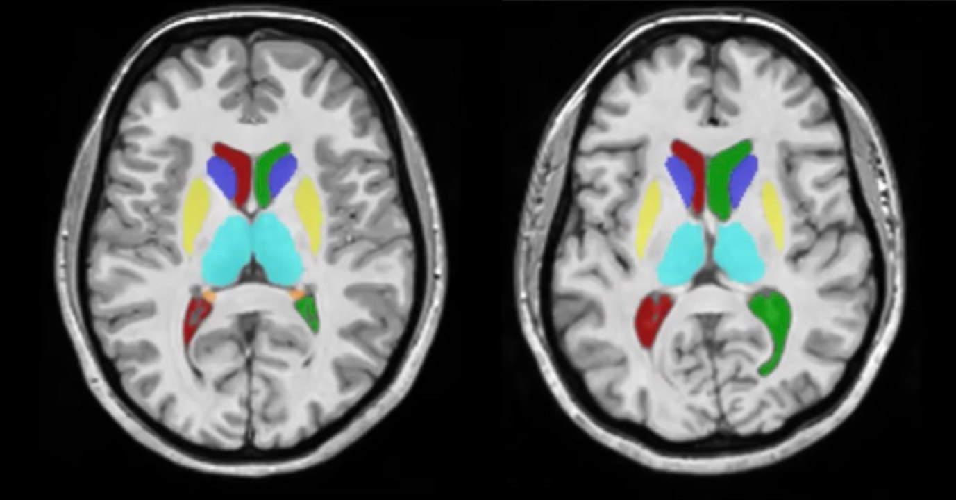 Des chercheurs dévoilent comment notre cerveau évolue au cours de notre vie