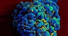 SIDA : un traitement anti-cancéreux montre des résultats prometteurs contre le VIH
