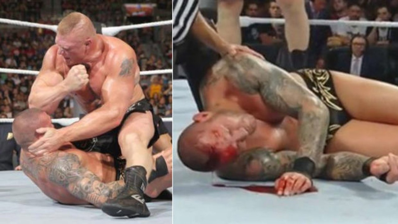 Brock Lesnar verletzt unabsichtlich Randy Orton beim SummerSlam