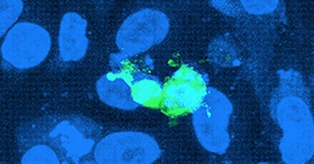 SIDA : une vidéo montre de façon inédite comment le VIH infecte des cellules