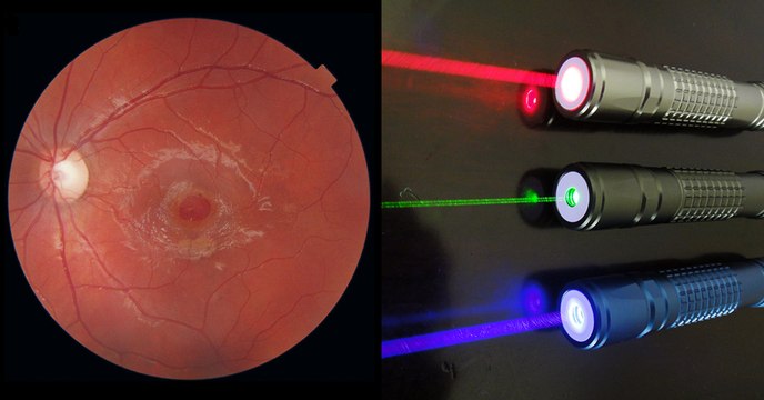 Pointeur laser : voilà pourquoi vous ne devez jamais regarder directement son rayon